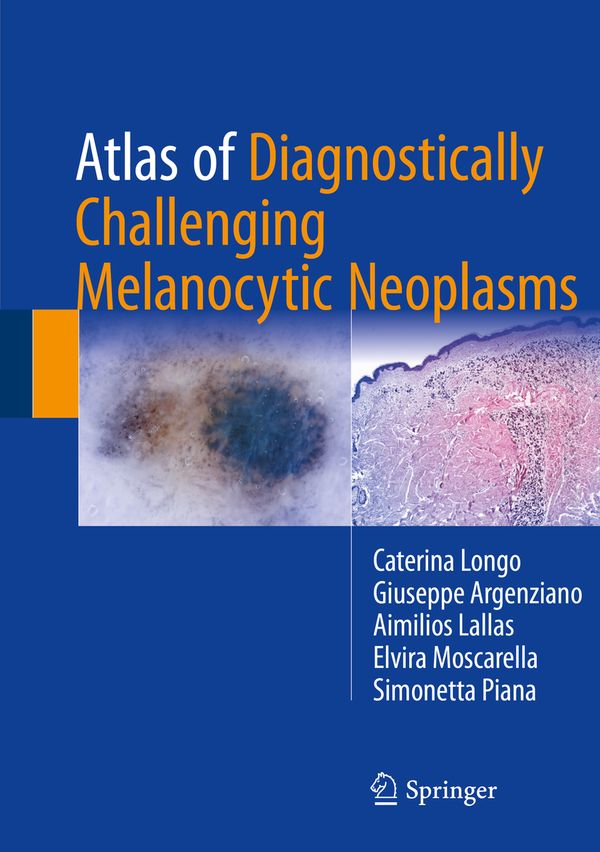 Atlas of Diagnostically Challenging Melanocytic Neoplasms | 1:a upplagan