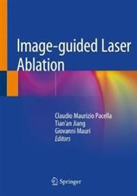 Image-guided Laser Ablation