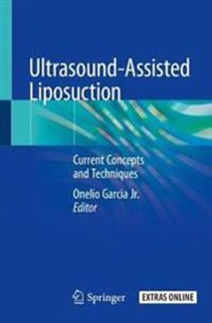 Ultrasound-Assisted Liposuction | 1:a upplagan