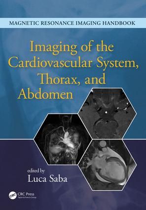 Imaging of the cardiovascular system, thorax, and abdomen | 1:a upplagan