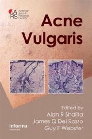 Acne Vulgaris | 1:a upplagan