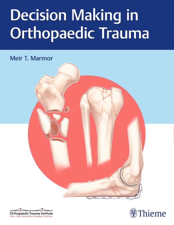 Decision Making in Orthopaedic Trauma | 0:e upplagan