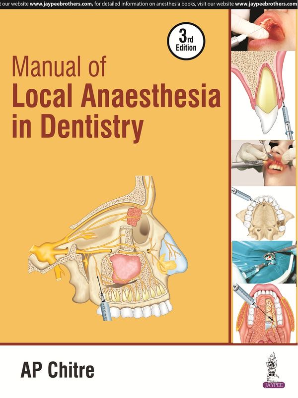 Manual of Local Anaesthesia in Dentistry | 0:e upplagan