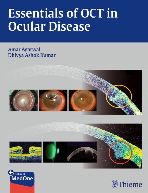Essentials of OCT in Ocular Disease | 0:e upplagan