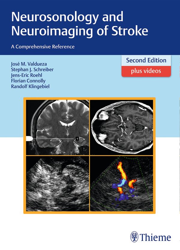 Neurosonology and Neuroimaging of Stroke | 2:a upplagan