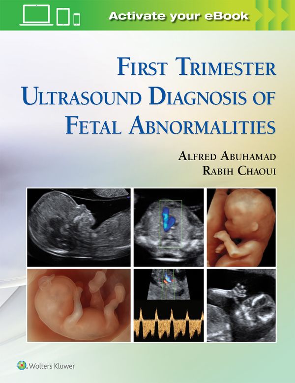 First Trimester Ultrasound Diagnosis of Fetal Abnormalities | 0:e upplagan
