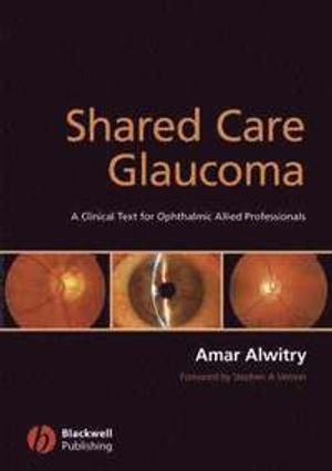 Shared Care Glaucoma: A Clinical Text for Ophthalmic Allied Professionals | 1:a upplagan