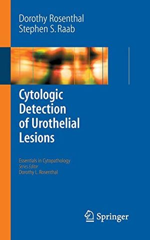 Cytologic Detection of Urothelial Lesions