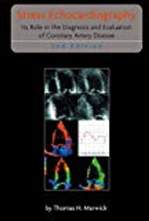 Stress Echocardiography