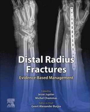 Distal Radius Fractures