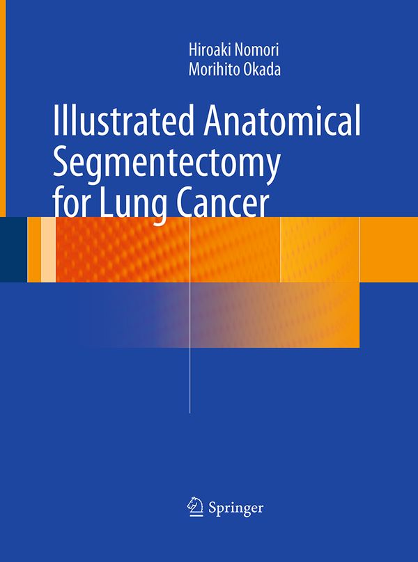 Illustrated Anatomical Segmentectomy for Lung Cancer | 1:a upplagan