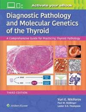 Diagnostic Pathology and Molecular Genetics of the Thyroid