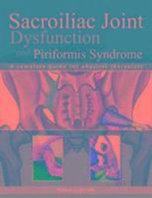 Sacroiliac joint dysfunction and piriformis syndrome - the complete guide f