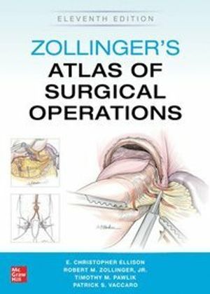 Zollinger's Atlas of Surgical Operations | 11:e upplagan