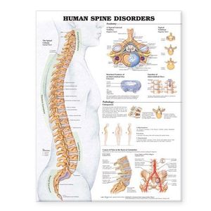 Human Spine Disorders Anatomical Chart