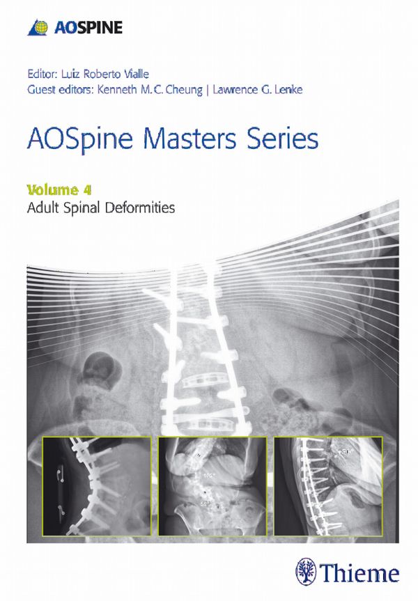 AOSpine Master Series, Vol. 4: Adult Spinal Deformities | 0:e upplagan