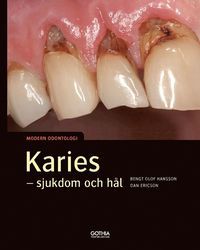 Karies sjukdom och hål :