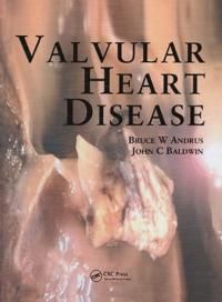 Valvular Heart Disease | 0:e upplagan