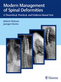 Modern Management of Spinal Deformities