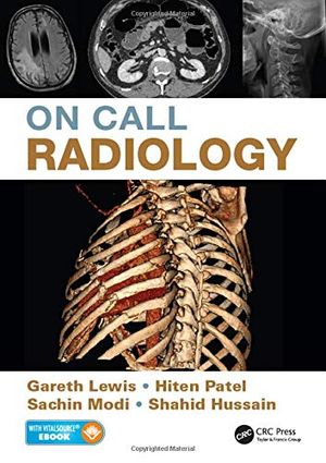 On Call Radiology