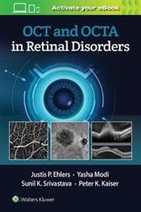 OCT and OCTA in Retinal Disorders | 0:e upplagan
