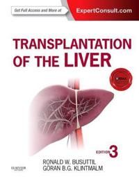 Transplantation of the liver | 3:e upplagan
