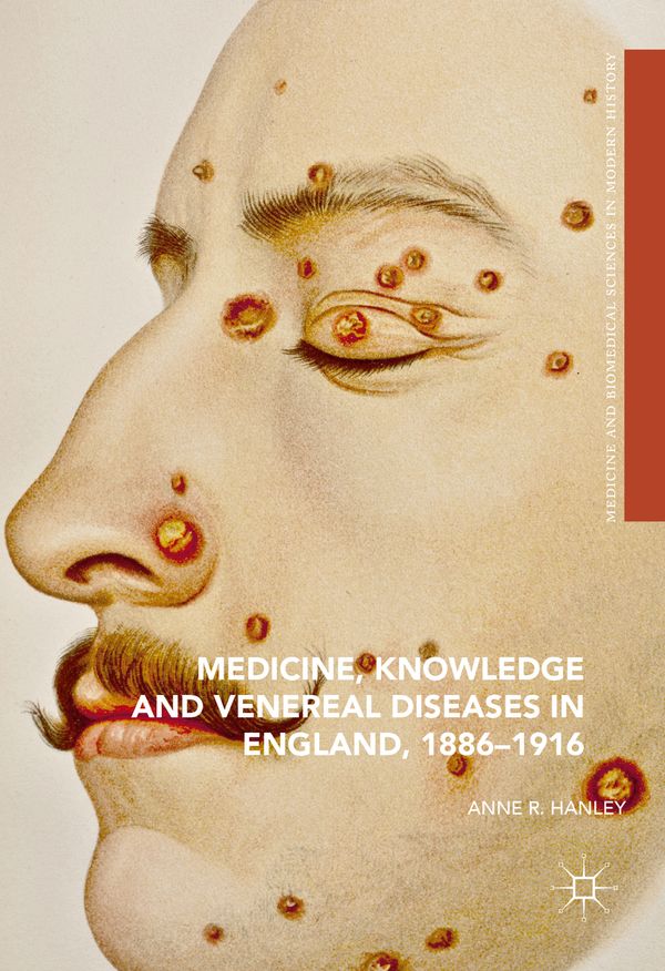 Medicine, Knowledge and Venereal Diseases in England, 1886-1916 | 1:a upplagan