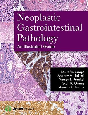 Neoplastic Gastrointestinal Pathology