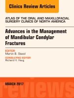 Advances in the management of mandibular condylar fractures, an issue of at | 0:e upplagan