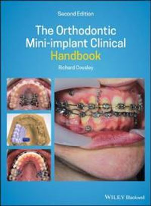 The Orthodontic Mini–implant Clinical Handbook |  2:e upplagan