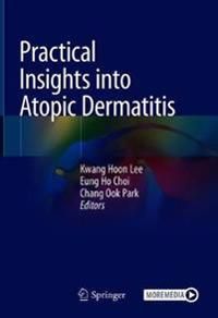 Practical Insights into Atopic Dermatitis