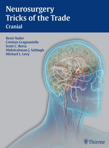 Neurosurgery Tricks of the Trade - Cranial | 0:e upplagan