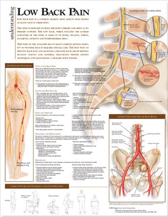 Understanding Low Back Pain Anatomical Chart | 0:e upplagan