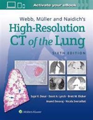 Webb, Müller and Naidich's High-Resolution CT of the Lung