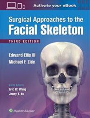 Surgical Approaches to the Facial Skeleton